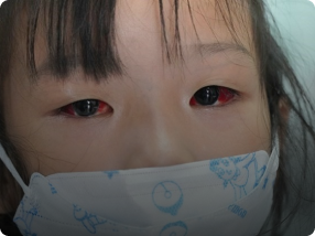 Đã có thêm những căn bệnh lạ làm đau đầu giới y học hiện đại ngày nay, thách thức nền y học